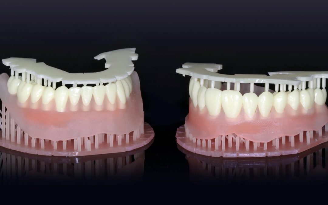 3d printing dentures