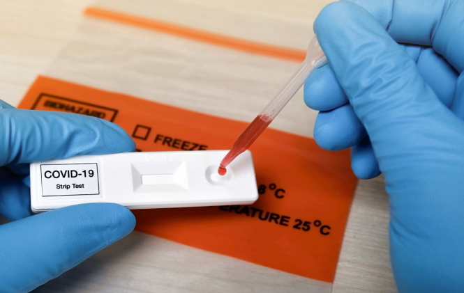 MDCG Guidance on COVID-19 Rapid Antibody Tests