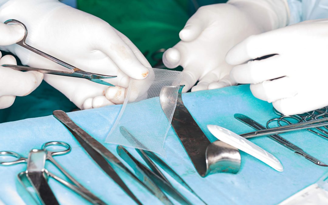TGA Guidance on Surgical Mesh Devices: Preliminary Assessment