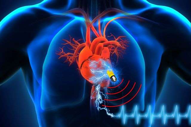 HSA Guidance on Labeling for Medical Devices: Implantable Devices and IVDs