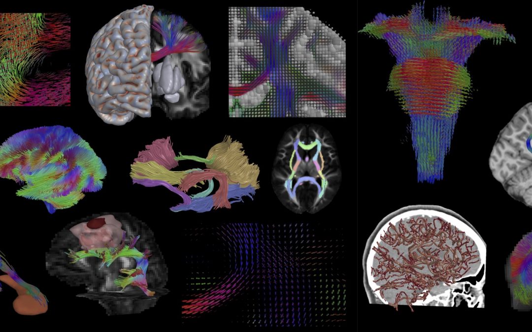 FDA Guidance on Quantitative Imaging: Overview