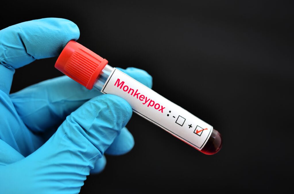 FDA Guidance on Monkeypox Tests: Modifications, Notification Content, and Reporting