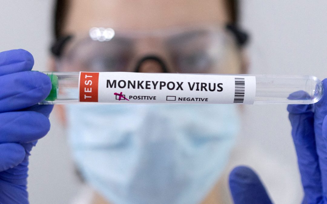 FDA Guidance on Monkeypox Tests: Overview