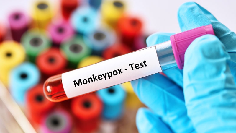 FDA Guidance on Monkeypox Tests: Initial Authorization