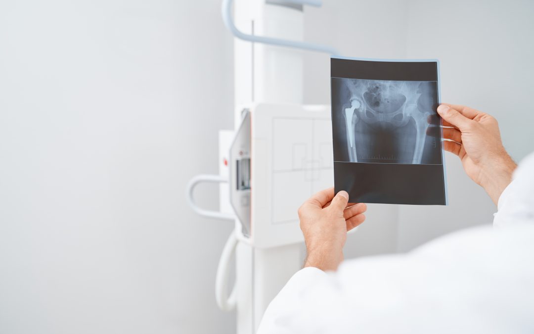 FDA Guidance on X-Ray Imaging Devices: Applicable Standards and Regulatory Overlap