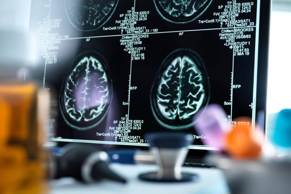 FDA on PMA for MRDDs (testing)2 FDA Guidance on Distinguishing Medical Device Recalls from Enhancements: Key Concepts and Definitions