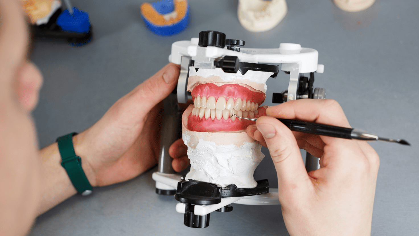 FDA Guidance on Performance Criteria for Dental Ceramics: Overview ...